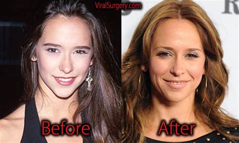 jennifer love hewitt breast reduction|Jennifer Love Hewitt: Before and After